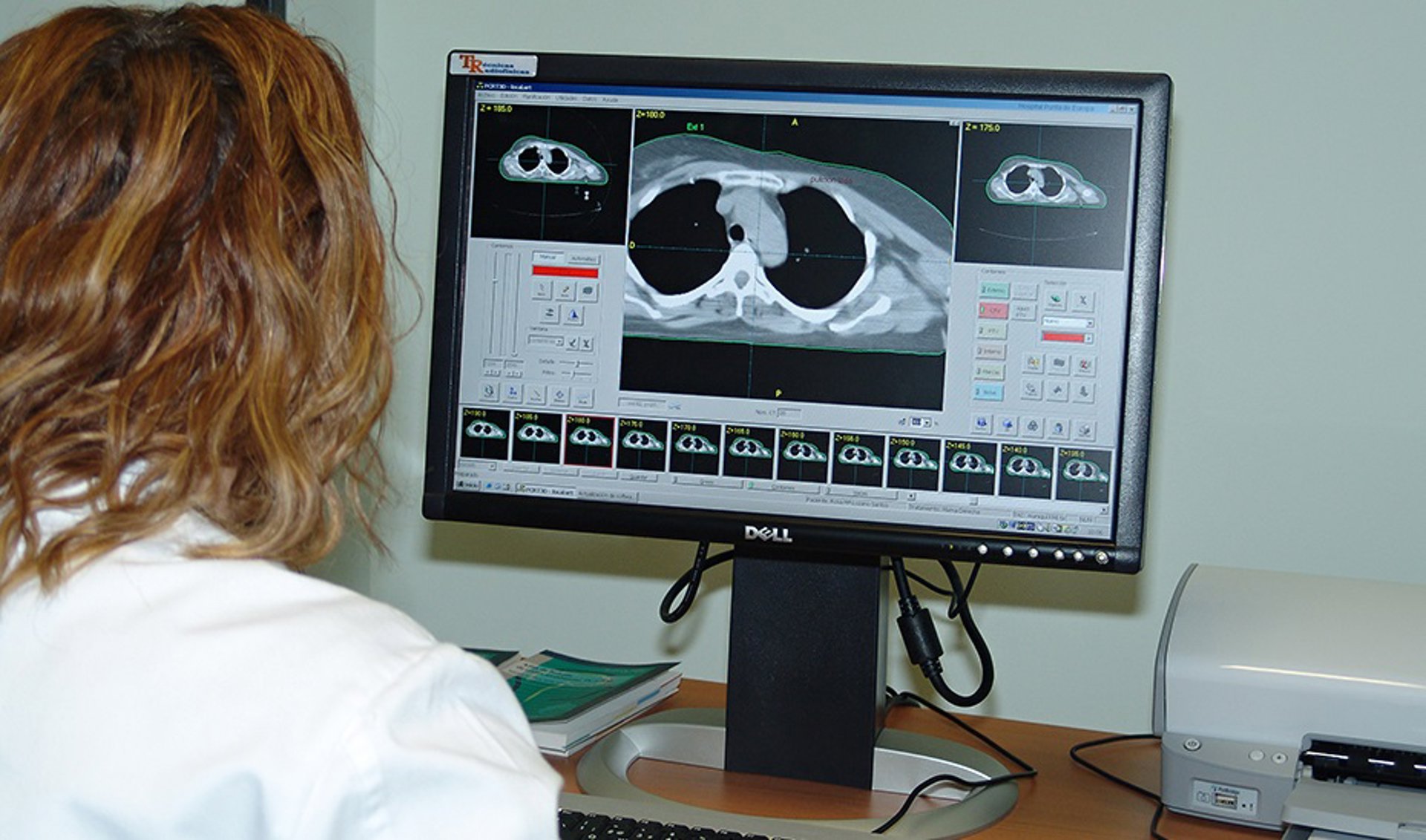 Aplican la IA para predecir posibles recaídas en pacientes con cáncer